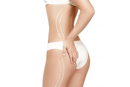 Hapros - Liposuction assisted with the 1470nm laser is a very common body contou ring procedure that has been performed safely for more than forty years,  thriving today also to Endolaser procedures, popular among professionals  because of its tightening properties.